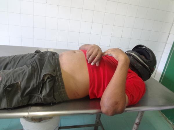 Homem morre após cair de moto em ponte da localidade Saco