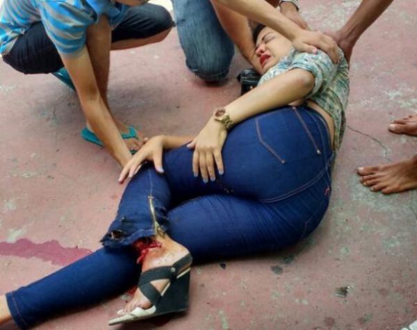 Acidente deixa v&iacute;tima com fratura exposta em Floriano.(Imagem:Reprodu&ccedil;&atilde;o/WhatsApp)