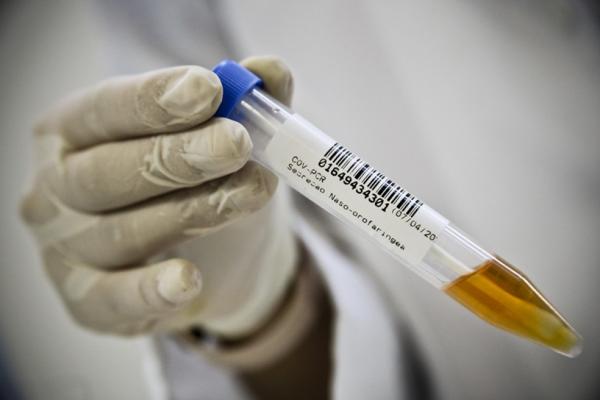 Piauí chega a 92.801 casos confirmados e 2.073 óbitos pelo coronavírus(Imagem:Divulgação)