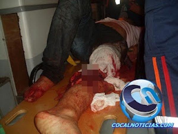 Colisão de moto com trator, deixa motoqueiro e garupeiro com fraturas expostas nas pernas