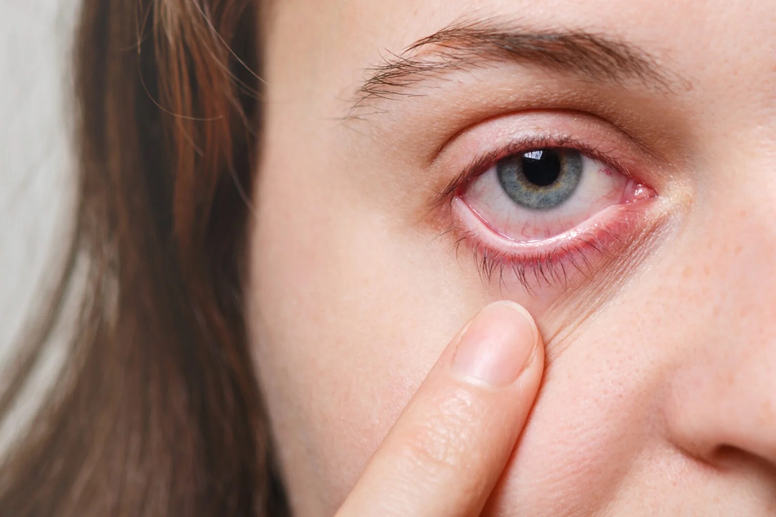Olhos secos e exposição à fumaça: veja riscos e cuidados
