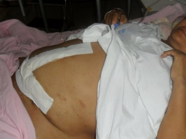 Mulher de MS tem bexiga perfurada em cirurgia no útero, diz família