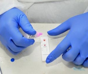 Piauí registra 159 casos confirmados e dois óbitos por Covid-19 nas últimas 24 horas