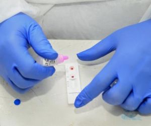 Piauí registra 429 casos confirmados e oito óbitos por Covid-19 nas últimas 24 horas