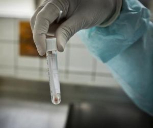 Piauí registra 252 casos confirmados e oito óbitos de Covid-19 nas últimas 24 horas