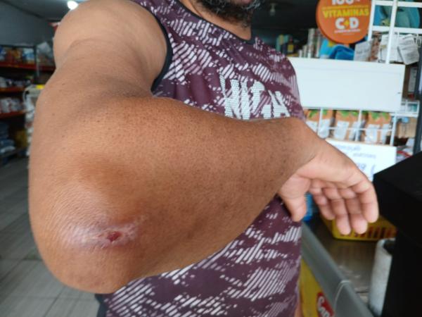 Morador denuncia perigo causado por animais soltos na PI-140 em Floriano(Imagem:FlorianoNews)