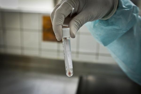 Novo boletim aponta tendência de queda nos casos de covid na 17° semana epidemiológica